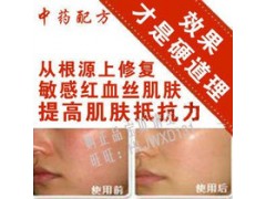 供應廣州去紅血絲修復套裝 去除祛紅血絲產品|OEM加工-- 廣州天斯秀爾化妝品有限公司