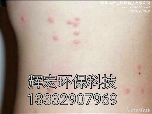 深圳殺臭蟲公司 |深圳殺臭蟲 |深圳宿舍殺臭蟲公司 |輝宏供-- 深圳市輝宏環?？萍加邢薰? class=